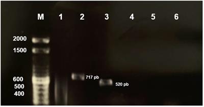 Assessment of Bacillus species capacity to protect Nile tilapia from A. hydrophila infection and improve growth performance